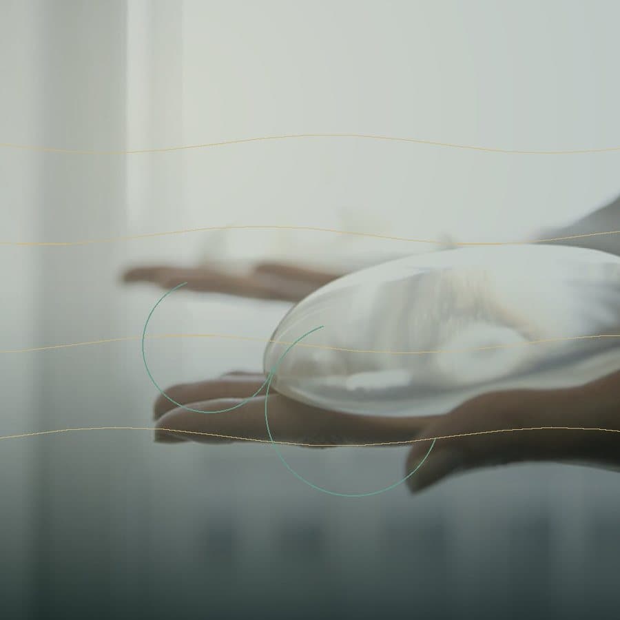 Silicone breast implant image representing breast reconstruction surgery