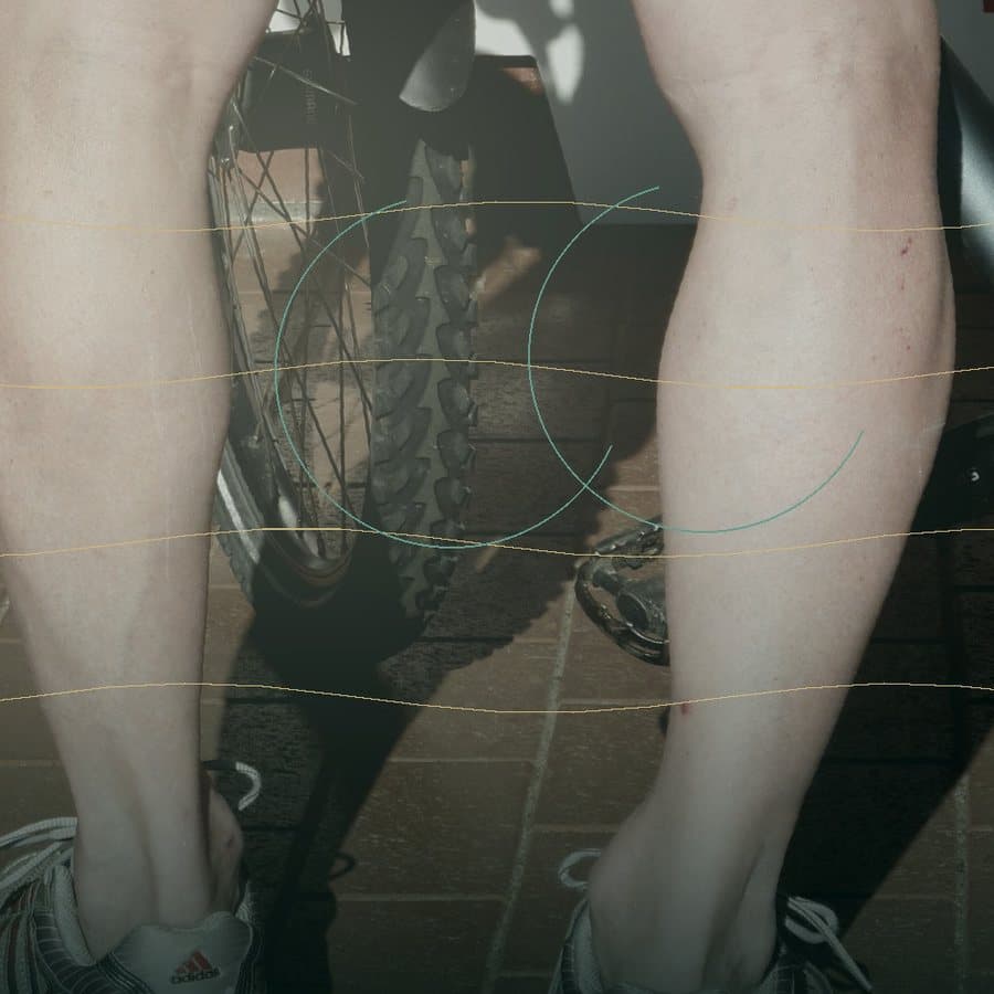 Leg image representing lower limb reconstruction